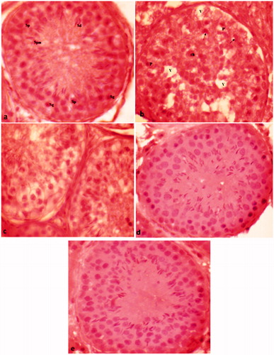 Figure 2. Photomicrograph of testicular tissue (a) showing normal arrangement of different types of germ cells [spermatogonia (Sg), spermatocytes (Sp), spermatids (Sd) & sperms (Spm)] in control group; (b) treated with atrazine (100 nmol/ml) showing a number of pycnotic nuclei (P), crescent-shaped nuclei (arrow), chromolysis (ch) and vacuolization (V) within the seminiferous tubule; (c) treated with atrazine (100 nmol/ml) supplemented with compound 6e showing reduction in atretic changes induced by atrazine after 6 h of exposure; (d) treated with atrazine (100 nmol/ml) supplemented with compound 6g showing decline in number of chromolysis, condensation and fragmentation; (e) treated with atrazine (100 nmol/ml) supplemented with compound 6f showing protection against atrazine-induced cytotoxicity. H&E (×1000).