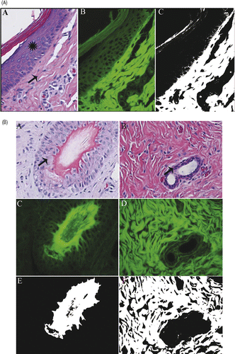 Figure 1. (A) Normal pig skin. Viable epidermal cells (star) exhibit minimal autofluorescence that is excluded (black) by the ImageJ filter (C). Dermal collagen (arrow) and superficial keratin are not excluded by the filter and remain white. H&E (A), fluorescent (B), and filtered (C) 400×. (B) Normal pig skin. Viable hair follicle (A,C,E) and mammary gland (B,D,F). Follicular and mammary epithelia (arrows) exhibit minimal autofluorescence that is excluded by the filter. H&E (A,B), fluorescent (C,D) and filtered (E, F) 400× magnification.