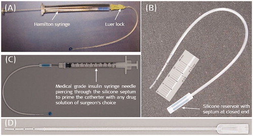 Figure 35. Version 1 of the IEC with Luer lock mechanism, connecting the Hamilton glass syringe to the backend of the catheter (A). Reconfigured catheter design with silicone reservoir with a septum at the back end of the catheter, and the reduction of intracochlear part of catheter length to 20 mm (B). Insulin syringe needle piercing and filling the reservoir with a drug solution (C). The current version of the commercially available IEC (D). Image courtesy of MED-EL.