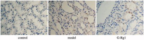 Figure 2. Cells apoptosis observed using TUNEL staining (original magnification 400×).