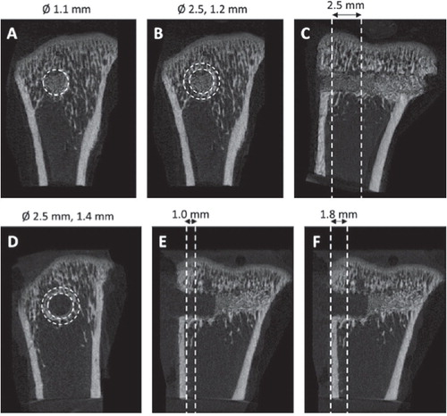 Figure 2. Regions of interest for microCT analyses of drill holes and PMMA screws. 4 volumes of interest were defined. A) For the drill hole: a cylinder with a diameter of 1.1 mm and 2.5 mm in length. B and C) For the bone adjacent to the drill hole: a cylinder pipe with an outer diameter of 2.5 mm and inner diameter of 1.2 mm, extending from the cortex 2.5 mm into the marrow cavity. D and E) For measuring the bone formation surrounding the screw: a cylinder pipe with an outer diameter of 2.5 mm, inner diameter of 1.4 mm, extending from the cortex 1.0 mm into the marrow cavity. F) For measuring the tissue mineral density (TMD) surrounding the screw a longer cylinder, 1.8 mm in length, was defined including the cortical bone.”