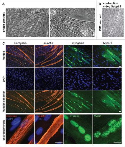 Figure 5. Microscopy analysis of myogenic proteins in AMC differentiated in myogenic direction. Typical data of one AMC culture is presented. All investigated AMC cultures obtained from ten different patients were able to differentiate in myogenic direction. (A) AMC derived myotubes phase contrast microscopy (Bars 25 μm). (B) AMC derived myotubes DIC microscopy. Suppl.2 myotube contraction video. (C) Immunofluorescence analysis of skeletal myosinandactin (red), myogenic transcriptional factors myogenin and MyoD1 (green), cell nuclei stained with DAPI (Bars 25 μm).