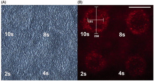 Figure 2. Light microscopy and fluorescence microscopy image of the marks of four pulse lengths (as indicated in the images). (A) The marks are barely visible in the light microscopy image, but clearly visible in the fluorescence image; (B) the white lines in the 10-s mark indicate how the diameter measurements were performed (scale:μm). Scale bar: 200 μm.