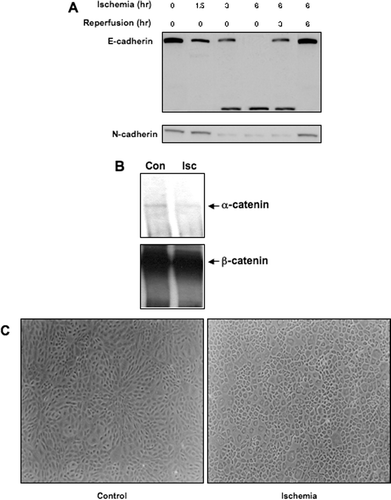 Figure 2 Impact of ischemia on cadherin and catenin protein expression and function in NRK cells. Ischemia was induced in NRK cells by layering cells with PBS supplemented with 1.5-mM CaCl2 and 2-mM MgCl2 followed by mineral oil. (a) NRK cell lysates were prepared at the given times and westerns were performed as previously described. Similar results were seen in three replicate experiments. (b) NRK extracts were immunoprecipitated with a goat polyclonal β-catenin antibody, and the immunoprecipitates were probed with a rabbit polyclonal α -catenin antibody. Following detection, the blots were stripped and reprobed with a monoclonal antibody against β-catenin as a loading control. Similar results were seen in two separate experiments. (c)Morphology of control and ischemic NRK cells, assessed by phase-contrast microscopy. The width of each field is 1600μ m.