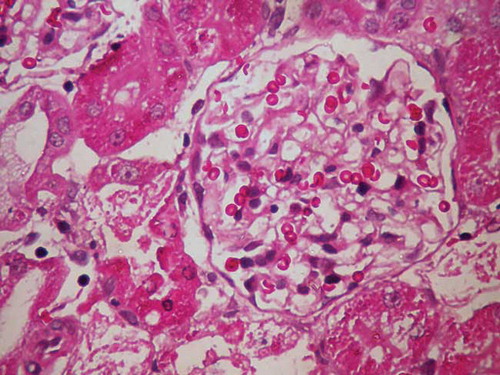Figure 2. Histopathological view of renal sections in G-group (HE ×400).