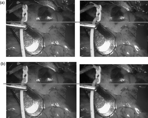Figure 3. (a) A standard laparoscopic image as viewed by the surgeon. (b) Rectified image as used by the registration algorithm. The warping between introduced and rectified image is visibly small. [Color version available online]