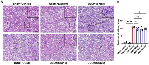 Figure 1. Iguratimod attenuates tissue damage in obstructed kidneys of UUO mice.Mice that underwent Sham surgery were treated with vehicle or iguratimod (10 mg/kg/day), and those that underwent UUO surgery were treated with vehicle or iguratimod (30, 10, or 3 mg/kg/day). (A) Hematoxylin and eosin staining of renal tissues. (B) The tubulointerstitial injury score. IGU: iguratimod; UUO: unilateral ureteral obstruction. The numbers in parentheses are drug concentrations. Scale bar (at the bottom right of the image) = 100 μm. Data are expressed as mean ± SEM, n = 5–7, *p < 0.05, **p < 0.01, ****p < 0.0001.