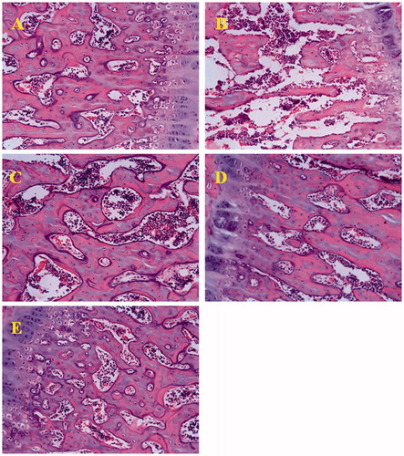 Figure 5. Effect of PXY on femur osseous tissue in ovariectomized mice. (A–E) The Sham, ovariectomized model, and PXY treatment (20, 40, and 60 mg/kg) are represented, respectively. The vehicle (10 ml/kg) and PXY were administered intraperitoneally.