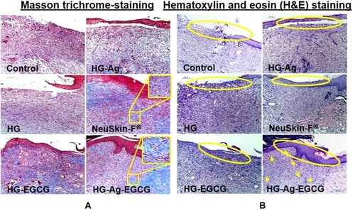 Figure 8 Effect of various hydrogel formulations on collagen synthesis and re-epithelialization. 12 days treated skin samples around the wound area were taken, and 5µ thin samples were cut by microtome for histo-pathological examination. (A) Representative photomicrographs of Masson trichrome-stained skin section showing enhanced collagen synthesis, firm-differentiated epithelium, and no visible inflammation or infection on HG-Ag-EGCG-treated sections while the control group showed more void spaces with loose crust. (B) Hematoxylin and eosin (H&E) stain shows HG-Ag-EGCG-exposed group has successful reepithelialization, granular tissue formation with enhanced neovascularization and densely packed keratinocytes (yellow arrows) (n = 3, scale bar 100 µm).