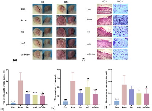 Figure 3. Effects of different intervention methods on the severity and histopathology of auricle lesions in SD rats of stage one. (A) The changes of auricle lesions of SD rats in each group after acne modeled. (B) The comparison of auricle swelling rate of SD rats in each group after acne modeled (n = 9). (C) The pathological changes of auricle tissue of SD rats in each group after acne modeled (40×, 400×). (D) The comparison of the number of Comedo in the rats' auricle pathological tissue in each group after modeled (n = 9) (HE staining, 40×). (E) The comparison of the number of inflammatory cells in the rats' auricle pathological tissue in each group after modeled (n = 9) (HE staining, 400×). * (acne vs.), *p < .05, **p < .01, ***p < .001; ▲ (Iso vs.), ▲p < .05, ▲▲p < .01, ▲▲▲p < .001; ♦ (ω-3 vs ω-3 + Iso), ♦p < .05, ♦♦p < .01, ♦♦♦p < .001; acne, the pure model group; Con, the blank control group; Iso, acne model combined with the isotretinoin treatment group; ω-3, acne model combined with the ω-3 fatty acids treatment group; ω-3 + Iso, acne model combined with the ω-3 fatty acids plus isotretinoin treatment group.