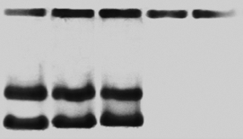 Figure 2. Electrophoresis for DNA concentration with polymer (DNA–Polymer Complexes for Gene Therapy, 2012).