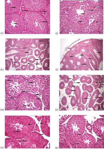 Figure 1. (Continued). (i) Cross section of testes of male albino mice treated with propolis for twoweeks showing normal structure at (400x), (H & E). Spermatocytes (Sp), interstitial cells (I C), basementmembranes (B M), seminiferous tubules (S T). (j) Testes of mice treated with propolis for three weeks(400x), (H & E). Lumen (L), basement membrane (B M), interstitial cells (I C), interstitial spaces (I S),seminiferous tubules. (k) Testes of mice treated with AlCl3 + vitamin E after 1 week (100x). Interstitialcells (I C), irregular shaped seminiferous tubules (Ir S T), damaged seminiferous tubules (D S T), bloodvessels (B V), interstitial spaces (I S), seminiferous tubules regular in shape (R S T), leydig cells (L C). (l)Cross section of testes of male albino mice showing effects after treatment with AlCl3 and vitamin E fortwo weeks at (100x), (H & E). The structure of seminiferous tubules (S T), lumen of the S T (L),interstitial spaces (I S). (m) Testes of mice showing effects after treatment with AlCl3 + vitamin E forthree weeks (100x). Seminiferous tubules (S T), basement membranes (B M), lumen having cells in it(L(c)), interstitial spaces (I S), interstitial cells (I C). (n) Testes of mice treated with AlCl3 and propolisfor 1 week (100x). Intercellular spaces (I S), decreased lumen (De L), basement membranes (B M),=irregular seminiferous tubules (Ir S T), contracted interstitial cells (I C). (o) Cross section of testes ofmale albino mice showing effects after treatment with AlCl3 and propolis for two weeks at (100x), (H & E). Tunica albuginea (T A), damaged seminiferous tubules (D S T), interstitial cells (I C), blood vessels(B V). (p) Testes of mice treated with AlCl3 and propolis for three weeks (100x), (H & E). Seminiferoustubules (S T), interstitial cells (I C), blood vessels (B V), leydig Cells (L C)