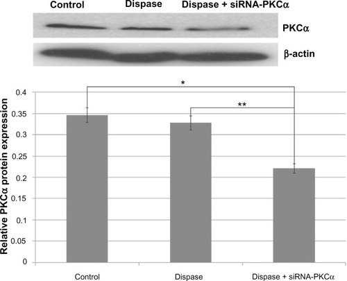 Figure 4 PKCα protein changes after siRNA-PKCα injection.Notes: Western blot analysis shows that PKCα decreased compared to those from the dispase-injected and control groups (ANOVA, *P = 0.00220 < 0.01, **P = 0.00490 < 0.01). The β-actin band with 42 kDa is used for quantitation.Abbreviations: PKCα, protein kinase C-alpha; siRNA-PKCα, small interference RNA-protein kinase C-alpha; ANOVA, analysis of variance.
