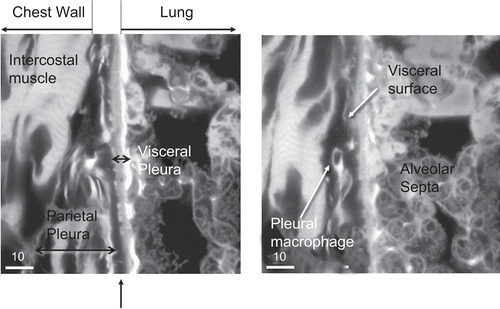 Figure 20.  Chest wall: low temperature photomicrographs of the pleural space were recorded at selected locations to examine the presence of possible intrapleural pathology and inflammatory cells. The pleural space was surveyed for the presence of inflammatory cell accumulation and foreign bodies/fibers. The micron bar in the lower left corner is 10 µm in length.