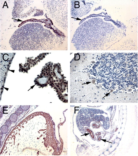 Figure 1.  Immunohistochemical staining for PHPT1. A: An E14.5 mouse embryo sagittal section shows PHPT1 signal in the epithelium of the choroid plexus in the fourth ventricle of brain (arrow). B: Adjacent section of A, using preimmune serum as a negative control. C: The same expression pattern of PHPT1 was found in the epithelium layer of the choroid plexus in an adult mouse brain (arrow). Arrowheads point at the ependymal cells in the ventricle. D: Purkinje cell (arrow) in the cerebellum expressing PHPT1. E: PHPT1 expression in the E14.5 embryonic heart muscle. F: PHPT1 expression (arrow) in the epithelium layer of the developing gut of an E14.5 sagittal section. Amplifications were 100× for A, B, and E, 400× for C and D, and 25× for F.