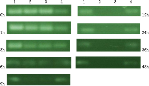 Figure 6. SiRNA serum stability experiments. Lane 1, Marker; Lane 2, pure siRNA; Lane 3, siRNA-PLL; Lane 4, siRNA in MEND.