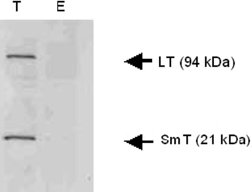 Figure 7. Western blots of the eluants from nickel-chromatography of cell culture supernatants of sgrp170-transfected Cos-7 cells (T) and mock-transfected Cos-7 cells (E) using an antibody specific to both small and large T-antigens.