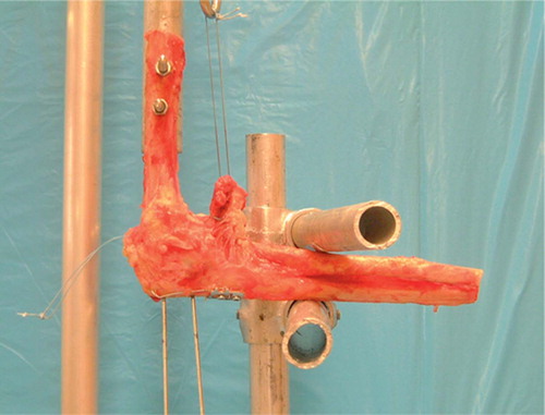 Figure 3. Loading of the brachialis muscle to measure deflection at the fracture site in a cadaver arm fixed at 90° flexion. Notice the low profile of the sled.