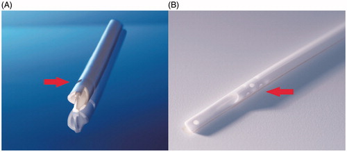 Figure 1. Close-up view of the (A) symmetrical catheter (Tal Palindrome™) tip showing the symmetrical spiral-tip design and laser-cut side slot (arrow), and (B) the step-tip catheter (Quinton™ Permcath™), showing the side holes (arrow) and staggered tip, which provides a 2.5 cm separation between the arterial lumen and venous tip.