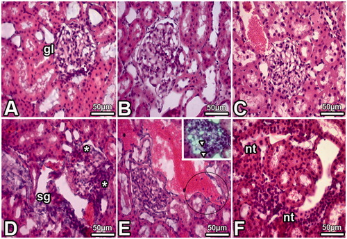 Figure 1. Images obtained from the kidney of the DS (D, E, F), Cont (A), PS (B) and DS + MEL (C) groups. Notes: Tubular necrosis (nt), sclerosis (sg), dilated glomerular capillaries (arrowheads), many mononuclear cells (in circled area) and segmental necrosis (*) of the glomeruli were detected in kidney samples of the DS group.