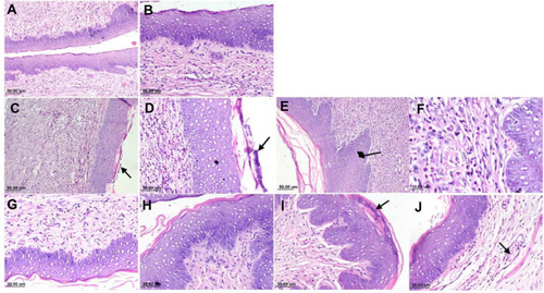 Figure 10 Photomicrograph of rat vagina, H&E stain: (A) Negative control group, normal histology of rat vagina; (B) negative control group, higher magnification, showing stratified squamous epithelium with dense sub-epithelial connective tissue; (C) positive control group, showing heavy subepithelial inflammatory cells infiltration with necrotic debris over the mucosal surface (arrow); (D) positive control group, higher magnification, showing dissolution of keratin layer with presence of necrotic tissue debris; (E) positive control group, showing hyperplastic mucosa (arrow); (F) positive control group, showing sub-epithelial neutrophils and mononuclear infiltration; (G) mucoadhesive liposomal gel group, showing mild sub-epithelial inflammatory cells infiltration; (H) showing intact mucosa; (I) sertaconazole control gel, showing mucosa with presence of necrotic debris in the keratin layer and (J) showing mild sub-epithelial edema with dilated blood vessels (arrow).