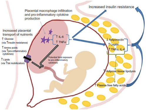 Figure 1 Placental and adipose tissue physiology in obese pregnancy.