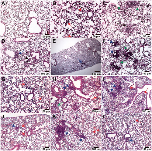 Figure 1. H&E stained histopathological lung sections of mice exposed to 0 or 54 μg MWCNT. (A–F) Representative images of the most predominant histological changes. (G–L) Representative images of Group I MWCNT on day 28 (G–I) and 92 (J–L). Lymphocytic aggregates (Lycy) and foreign material-containing alveolar macrophages where found in all groups of mice exposed to 54 μg MWCNT and are commonly marked with blue and red arrows, respectively, across all images. Objectives are 10× unless otherwise stated. (A) Negative control on day 92. (B) NRCWE-041 on day 92. MWCNT are mainly localized in alveolar macrophages (red arrows). Objective 20×. (C) NRCWE-040 on day 92. Non-dust granuloma (black arrow). Non-collagenous, slight thickening of alveolar ducts and alveolar walls, with hyperplasia of type II cells (green arrows). Objective 20×. (D) NRCWE-040 on day 92. Small CNT-laden (foreign body) granulomas (black arrow). Small perivascular Lycy (blue arrow). (E and F) NRCWE-045 on day 28. Small area of perivascular Lycy (blue arrows). Focal alveolitis (green arrows). For image E the objective was 2×. (G) NRCWE-040 on day 28. (H) NRCWE-041 a on day 28. Slight focal alveolitis, with inflammatory cells and debris in alveoli (green arrow). (I) NRCWE-042 on day 28. (J) NRCWE-040 on day 92. (K) NRCWE-041 on day 92. (L) NRCWE-042 on day 92.