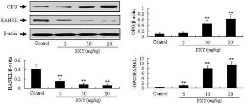 Figure 6. Effect of PXY on expressions of OPG and RANKL in osteoblasts. Osteoblastic cells from neonatal rat calvarias were treated with PXY treatment (5, 10, and 20 μM) for 48 h. Protein expressions of OPG and RANKL were determined by western blotting, and β-actin was used as an internal reference. Data were presented as mean ± standard deviation (n = 4), **p < 0.01, compared with control.