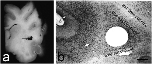 Fig. 1. An overview of the dorsal claustrum in cat. (a) A section through the brain showing the site (black arrow) from which the material for electron microscopy was obtained. (b) Histological control image of a Nissl stain showing the localization of the dorsal claustrum. Scale bar −500 µm.