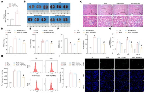Figure 7. The influence of POP-NPs on the RI/R and miR-410-3p/Nrf2/HO-1 pathway in vivo. (A) Detection of OIP5-AS1 expression in the tissue. Normal mice were injected with either Vector or POP-NPs. (B) Representative images of mouse kidney tissue. (C) Representative images of H&E staining. (D and E) Representative bar graphs of BUN and Cre levels detected through ELISA. (F) Representative bar graphs of SOD and MDA levels in serum detected using biochemical assay kits. (G) The representative bar chart of the concentrations of inflammatory factors IL-8, IL-6, and TNF-α was detected by RT-qPCR. (H) The ROS levels were detected using a ROS assay kit. (I) The representative image and quantification analysis of renal tissue apoptosis levels. (J) Representative images of the OIP5-AS1, miR-410-3p, and Nrf2/HO-1 gene expressions were determined by RT-qPCR. (K) Representative images of the Nrf2/HO-1 protein expressions were determined by western blot. (L) The representative images showcasing the expressions of Nrf2/HO-1 and their quantitative statistics were gathered through IHC. n = 6–8 mice/group, ANOVA, *p < .05, vs. the Ctrl, #p < .05 vs. the RI/R + Vector.