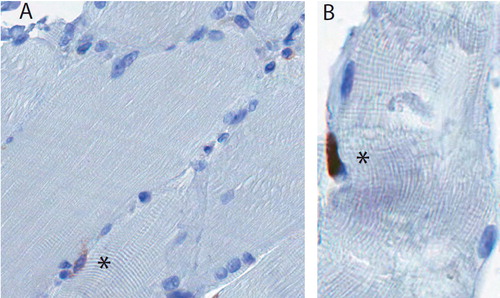 Figure 3. A. Satellite cells were defined as CD56+ cells at the periphery of the myofiber (marked with an asterisk). B. A Ki67+ cell (asterisk), which appears to lie outside the sarcolemma, in the expected location of a satellite cell.