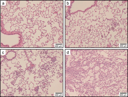 Figure 10.  Light micrographs of lung tissue sections of rats at 6 months after instillation in experiment 2 (H&E stain). Minimal macrophage accumulation was observed in the alveoli of the vehicle control group. Minimal macrophage accumulation was observed in the alveoli of the 0.04 mg/kg SWCNT-exposed group (panel b). Minimal macrophage accumulation in the alveoli and interstitium were observed in the 0.2 mg/kg SWCNT-exposed group (panel c). Mild macrophage accumulation accompanied with foamy macrophages and minimal inflammatory cell infiltration, minimal macrophage infiltration in the interstitium, and minimal hypertrophy of alveolar epithelium were observed in the 1 mg/kg SWCNT-exposed group (panel d).