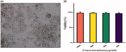 Figure 8. The HepG2 cells in cultivation medium (A). The cytocompatibility checking of P(NIPAM-co-DMA) nanogel using MTT assay which showed no significant cytotoxicity to HepG2 cells (B).