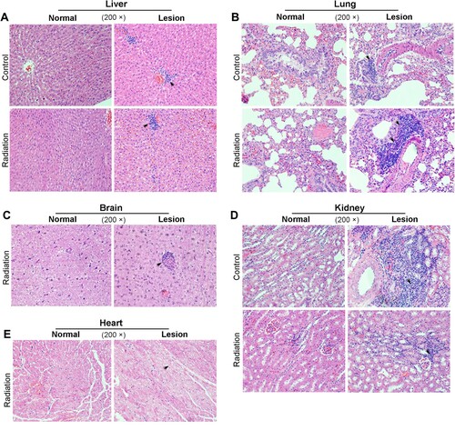 Figure 3. Histopathology analysis of rabbit tissues after 16 weeks-mobile phone radiation. Rabbit tissues were analyzed by H&E staining. Radiation, rabbits exposed to mobile phone radiation. Control, rabbits without exposure to mobile phone radiation. Normal/Lesion, normal or lesion tissues observed. Inflammatory cell infiltration (A, B, C, D) and cytoplasmic vacuolation (E) were indicated by black arrows. Representative results were shown. 200×, magnification.