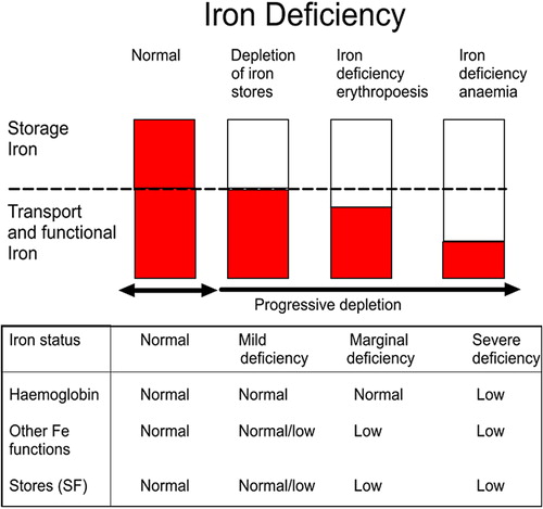 Figure 2. (1) Normal with good iron stores; (2) mild deficiency where the mobilizable iron stores in the bone marrow become depleted but there is normal production of iron-dependent proteins; (3) marginal deficiency or iron deficient erythropoiesis which affects iron-dependent protein production but hemoglobin production and erythropoiesis are preserved; and (4) iron deficiency anemia (IDA) where the production of hemoglobin is compromised and red blood cell synthesis abrogated because there is insufficient iron for incorporation into erythroid precursors.