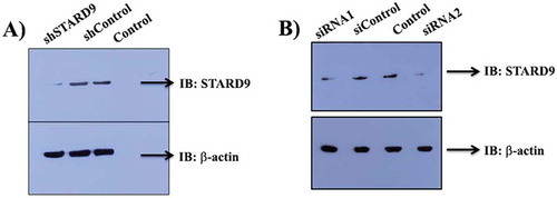 Figure 1. Depletion of STARD9 with shRNA and siRNA. Western blot of control, shControl, shSTARD9 (a), siControl, and siRNAs (b) treated cell extract of HeLa cells. The experiment was performed thrice for shRNA and twice for siRNA.