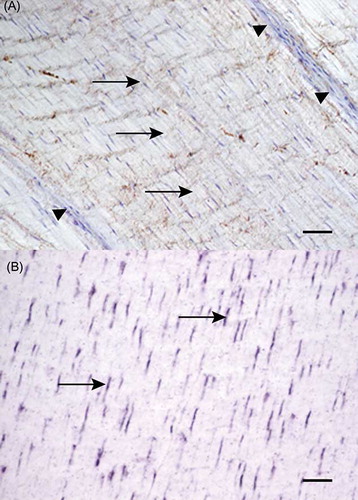 Figure 6. Microscopic longitudinal section of an injured tendon (C). A: Immunohistochemical localization of COMP in a fibroblastic organized region with a marked staining (arrows) and in endotenon (arrowheads). Bar = 100 μm. B: In situ hybridization with the expression of COMP m-RNA (dark stain) in the cytoplasm of the majority of cells (arrows) in the same region as a). C refers to tendon ID (see Tables 1 and 2). Bar = 100 μm.