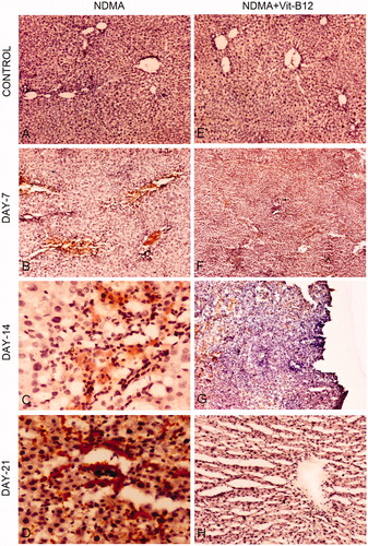 Figure 4. Immunohistochemical staining for α-SMA during the pathogenesis of NDMA-induced hepatic fibrosis and subsequent treatment with vitamin B12. (A) Normal liver with central vein (4×). (B) Day 7. Focal α-SMA staining around central vein positively stained stellate cells (10×). (C) Day 14. Focal positivity and α-SMA stained regions showing widespread activation of hepatic stellate cells (40×). (D) Day 21. Stellate cells showing intense focal staining of α-SMA in fibrotic region (40×). (E) Normal liver architecture in vitamin B12 treated rats (4×). (F) Day 7. Focal positivity of α-SMA (4×). (G) Day 14. Scattered and decreased focal positive staining of α-SMA showing reduced number of activated hepatic stellate cells (10×). (H) Day 21. Regenerating hepatocytes with scant positivity around central vein (4×).