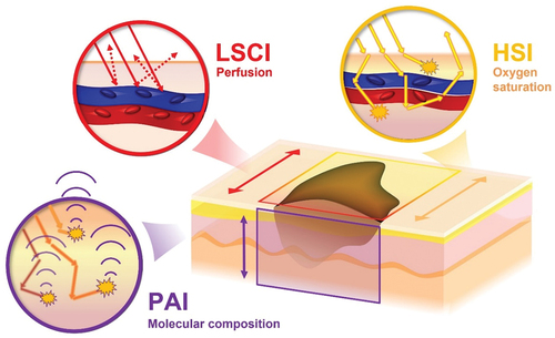 Figure 1. Schematic illustration of the combination of imaging modalities in the present study. Laser speckle (LSCI) and hyperspectral imaging (HSI), being so-called “light in – light out” techniques, provide 2D maps of the surface capable of depicting the tumor blood perfusion and oxygen saturation respectively. Photoacoustic imaging (PAI), a “light in – sound out” technique, can provide 3D maps of the molecular properties of tumor. The combination of techniques thereby has the capacity to provide detailed information of the functional and molecular properties of tumors useful in preoperative assessment.