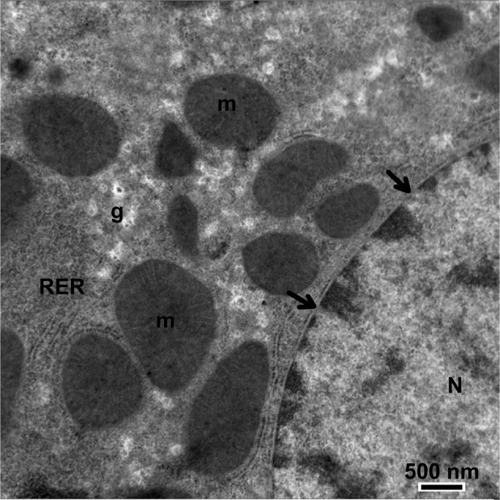 Figure 14 Magnified micrograph of a hepatic cell from the control group showing the normal ultrastructure of the nucleus and its nuclear membrane, containing nucleopores (arrows), well developed rough endoplasmic reticulum, well developed mitochondria, and glycogen granules. Scale bar 500 nm.Abbreviations: g, glycogen granules; m, mitochondria; N, nucleus; RER, rough endoplasmic reticulum.