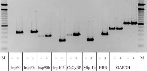 Figure 2. Semi-quantitative RT-PCR (sqRT-PCR) with 1:10 diluted second suppressive PCR material as template generated from combined RNAs from all patients, −: before and +: after WBH with simultaneous chemotherapy, M: 100 bp ladder. Shown are identical cycles for every gene tested. Genes induced are shown (HSP60, HSP90a, HSP90b, HSP105, CacyBP, MIP-1 beta, HBB and the house keeping gene GAPDH for control).