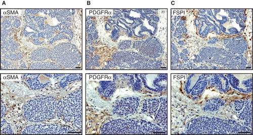 Figure 2. Expression of fibroblast markers in 14-week-old MMTV-PyMT mice. Representative immunostaining of tumour tissue from a 14-week-old MMTV-PyMT mouse showing the expression pattern of ASMA (A), PDGFRα (B), and FSP1 (C). The staining pattern for ASMA and PDGFRα shows similar staining pattern where staining of spindle-shaped stromal cells could be seen. For FSP1 not only stromal streaks were stained but also some cells intermingled in the epithelial islets. Scale bar is indicated in the figure and represents 50 µm.