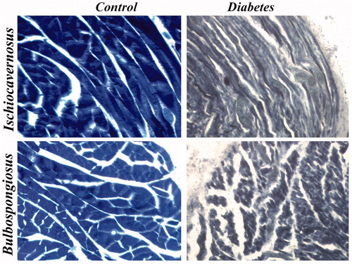 Figure 12. Images of histochemical staining for NADPH diaphorase. Staining showed severe depletion of enzyme in diabetic group IC and BS muscles when compared to control group. 40×.
