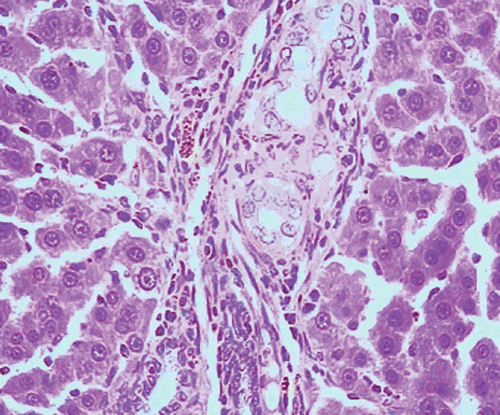 Figure 2.  Microphotograph of liver sections taken from rats of CCl4 group, (1 mL/kg of 40% solution, s.c.). H and E staining (× 400).