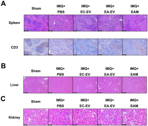 Figure 6. Effects of EV treatment on major organs in the psoriasis-like mouse model. (A) H&E and CD3 IHC staining of the spleen. (B) H&E staining of the liver. (C) H&E staining of the kidney.