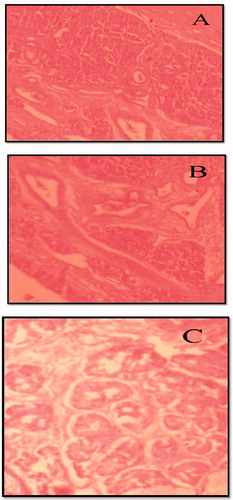 Figure 6. Microscopic images illustrate the histopathological condition of nasal mucosa after 6 h exposure to (A), negative control-simulated nasal fluid pH 6.4; (B) CRM-loaded NLC, and (C) positive control IPA.