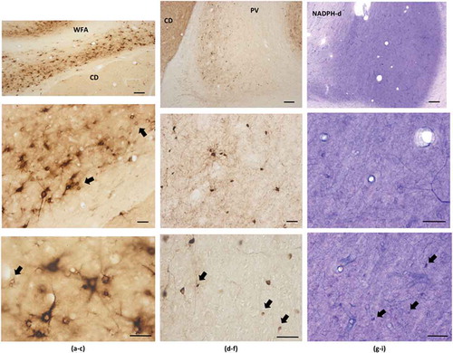 Fig. 5. Immunohistochemical staining for WFA (a–c), PV (d–f), and NADPH-d (g–i). Dorsal is at the top, except for the WFA images, which have been rotated with dorsal to the right. Examples of small neurons are indicated by arrows, including (d) a closely adjacent pair. CD = caudate. Scale bars: (a, d, and g) = 200 µm; otherwise, 50 µm.