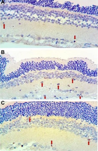 Figure 1 Micrographs of retinal TUNEL staining for one rat in each treatment group.