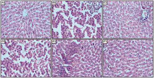 Figure 4. Effect of naringin on sodium arsenite-induced alteration in liver histology of rats. Photomicrograph of sections of liver from normal group (A); Arsenic Control group (B); Coenzyme Q10 (10 mg/kg, p.o.) treated group (C); Naringin (20 mg/kg, p.o.) treated group (D); Naringin (40 mg/kg, p.o.) treated group (E) and Naringin (80 mg/kg, p.o.) treated group (F). H & E staining at 100×.
