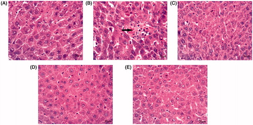 Figure 5. Histopathology of liver. (A) Normal control – normal hepatocytes showing normal architecture. (B) Diabetic control – extensive hepatocellular damage in the form of inflammation, sinusoidal dilation, fatty changes, and extensive vacuolization with disappearance of nuclei. (C)–(E) Diabetic + CQSF shows only mild inflammation, and there is restoration of normal tissue morphology.